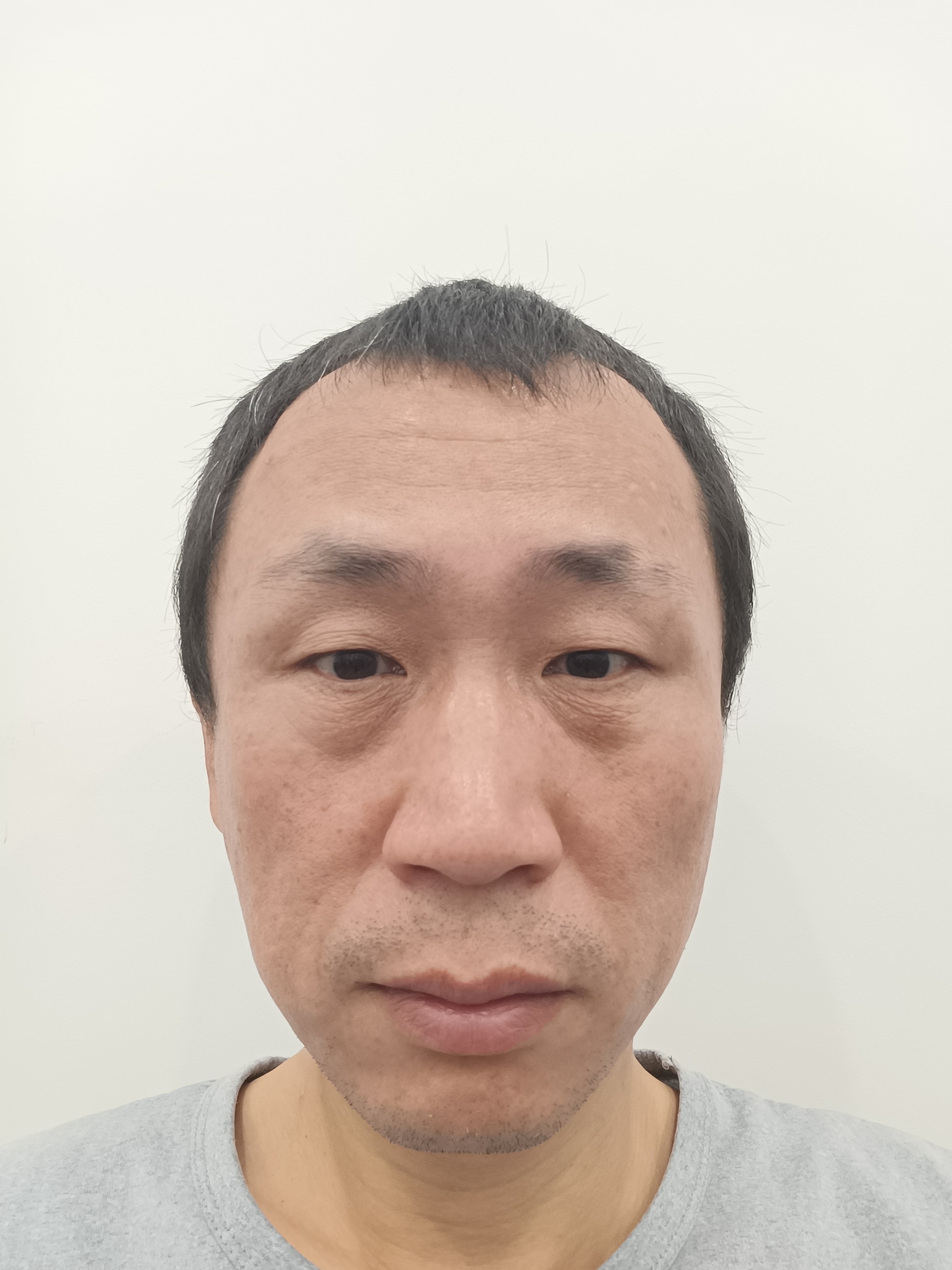 喜迎未来