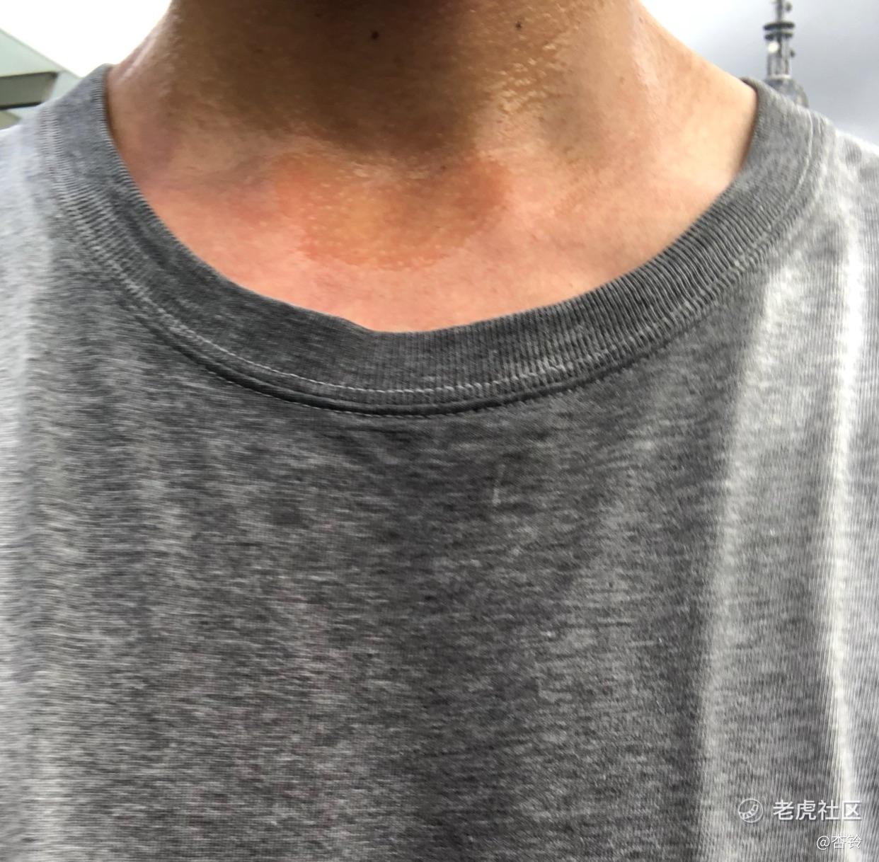 杏铃